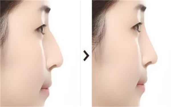 2023年中回顧！阜陽注射祛疤痕領(lǐng)域權(quán)威整形美容醫(yī)院排行榜TOP10強揭曉！