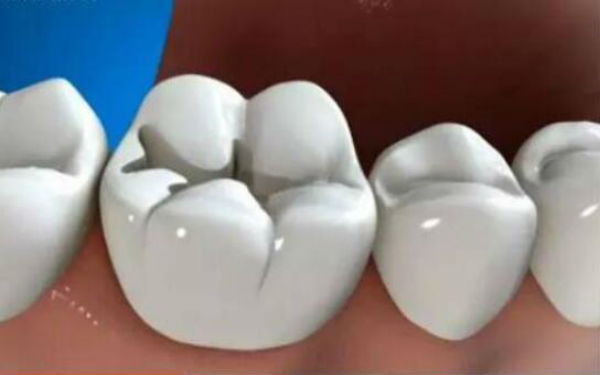 廣州整形醫(yī)療機(jī)構(gòu)，磨皮祛疤痕效果顯著，受到廣泛好評(píng)！2023年，廣州市百家整形醫(yī)院中，激光磨皮祛疤痕效果