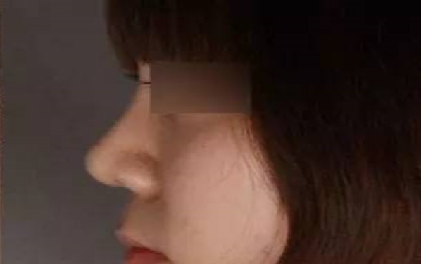 重慶哪家整形醫(yī)院祛黑眼圈效果靠譜？2023年重慶祛黑眼圈醫(yī)療機(jī)構(gòu)排名前十值得信賴嗎？