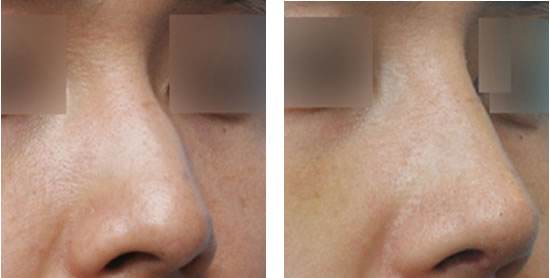 長沙法令紋填充，2023年10家美容醫(yī)院排名榜單發(fā)布