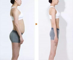 攀枝花市2023年最值得關(guān)注的高性價比v臉線雕醫(yī)院排行榜