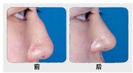 2023武漢去除口周紋醫(yī)院排名榜！高口碑醫(yī)院為你推薦