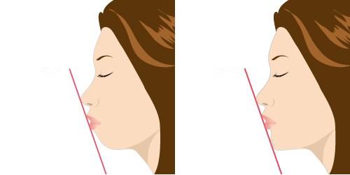 2023鄭州哪家口碑不錯的切開填充去痘疤整形美容醫(yī)院排行榜發(fā)布，前10強揭曉！