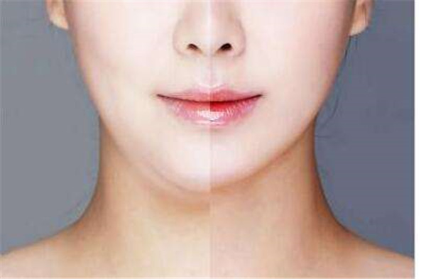 南京哪里可以做眉間紋注射填充手術(shù)？2023年南京眉間紋注射填充醫(yī)院實(shí)力排行榜發(fā)布！前十家醫(yī)療整形機(jī)構(gòu)評(píng)測(cè)