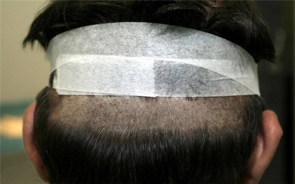 重慶哪家醫(yī)院豐唇口碑好？2023年榜單前十大整形美容醫(yī)院推薦！