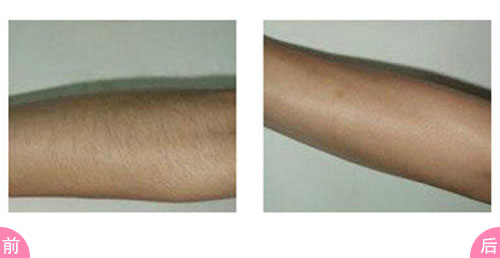 2023蘇州祛頸紋哪家醫(yī)院好？口碑比較好的10所整形醫(yī)院更新！