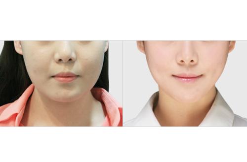 2023久負(fù)盛名的四川地區(qū)疤痕修復(fù)醫(yī)院排行榜TOP10！