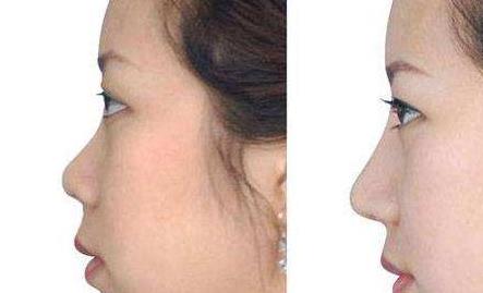 太原哪家醫(yī)院專業(yè)斑點祛老，口碑比較好？2023太原斑點祛老美容醫(yī)院排名TOP10熱門機構(gòu)推薦！