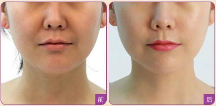 上海眉間紋醫(yī)療整形醫(yī)院強(qiáng)榜前10，選取眉間紋正規(guī)醫(yī)院指南