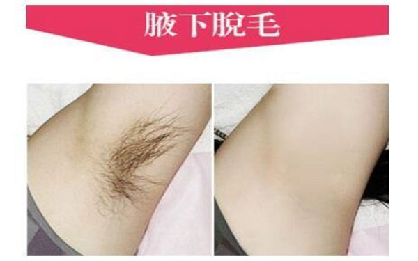 南通哪家醫(yī)院的微針祛除木偶紋技術(shù)好？2023年排行評價極高的南通整形美容醫(yī)院！