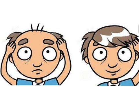 2023株洲眼紋肉毒素注射榜單揭曉！排名TOP10的正規(guī)醫(yī)院值得信賴！