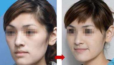 廈門注射膠原蛋白減少川字紋的整形醫(yī)院排名公開！2023廈門膠原蛋白去皺醫(yī)院前10強(qiáng)榜單揭曉！