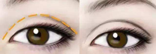 西安哪家醫(yī)院是比較好的雙眼皮下垂提拉整形美容醫(yī)院？2023年西安雙眼皮下垂提拉醫(yī)療整形醫(yī)院前10名推薦！