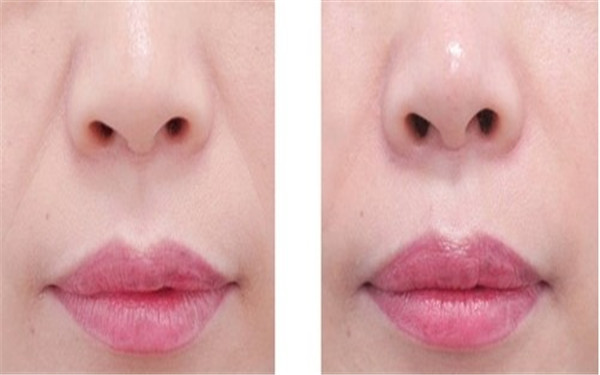 揭秘2023年海南十大專業(yè)除眼紋醫(yī)療美容醫(yī)院，哪些值得考慮！