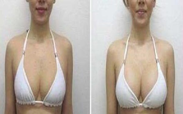 2023太原水光針去除色素沉重醫(yī)院TOP10，看看這些行之有效的整容美容醫(yī)院！