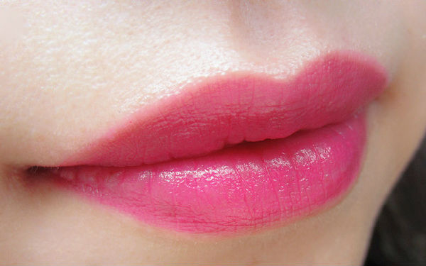 2023上海很受歡迎的射頻吸脂瘦肩部整形醫(yī)院排行榜公布！看看哪些醫(yī)院值得選擇