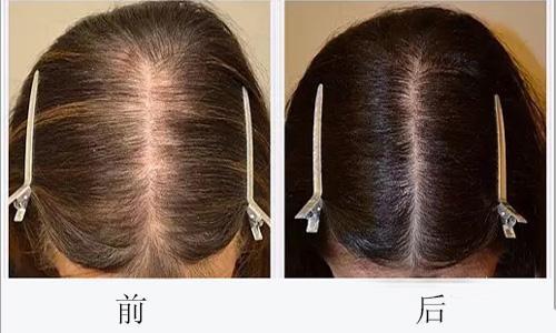 廣州哪些醫(yī)院可靠，專業(yè)進(jìn)行臉部疤痕切除整形美容？2023年十大排名公開！