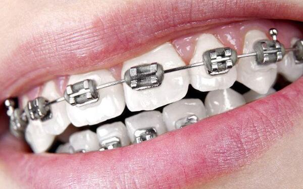 2023年北京微晶祛雀斑美容醫(yī)院排名前十，哪幾家值得去？