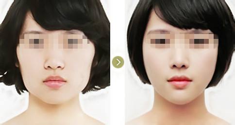 2023年濟(jì)南頸部皺紋填充醫(yī)療美容醫(yī)院哪家綜合實(shí)力更強(qiáng)？瀏覽排名前十強(qiáng)名單！