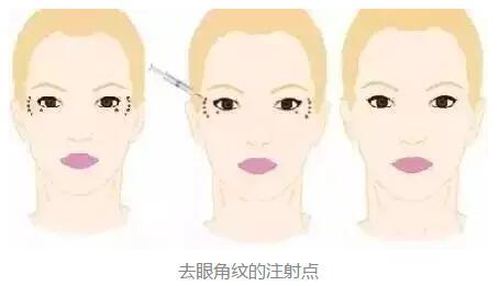 2023年北京鼻端缺損整形美容醫(yī)院前十強(qiáng)排名揭曉！知名度爆棚的醫(yī)療機(jī)構(gòu)盤點(diǎn)！