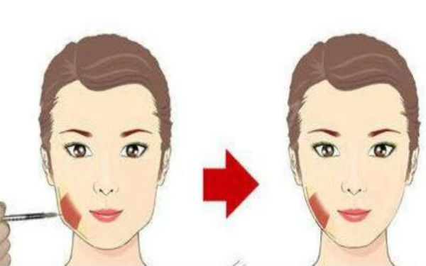 山西高口碑小切口除皺祛抬頭紋整形美容醫(yī)院推薦