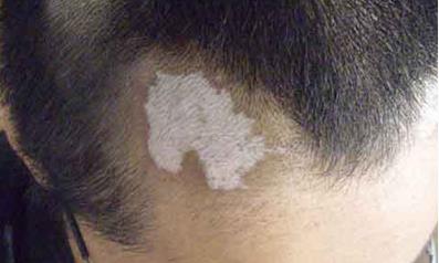 南寧哪家醫(yī)院除皺效果好？2023年排名前10強(qiáng)的正規(guī)醫(yī)院盤(pán)點(diǎn)！