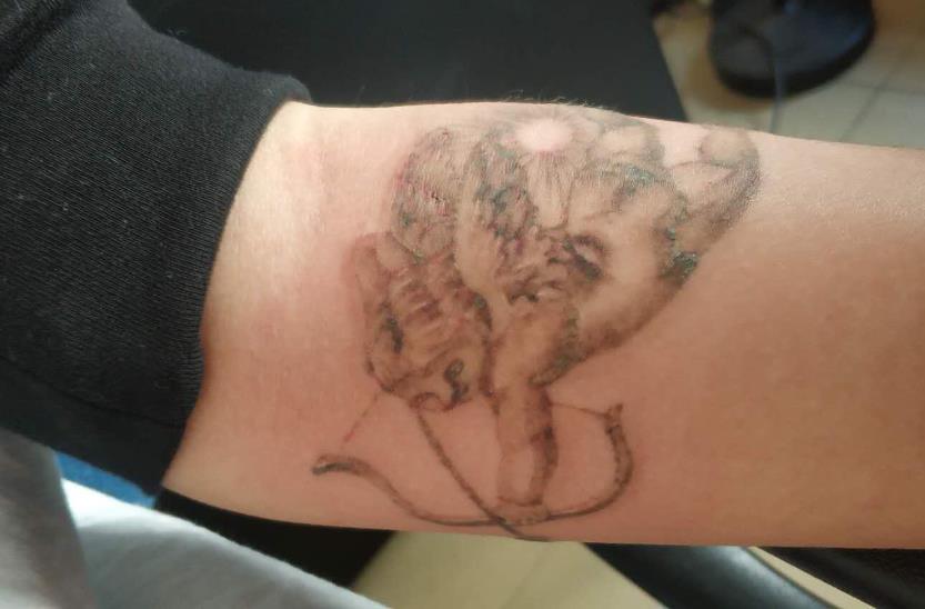 宿遷洗紋身醫(yī)院榮獲六強(qiáng)名單，口碑彰顯實(shí)力！