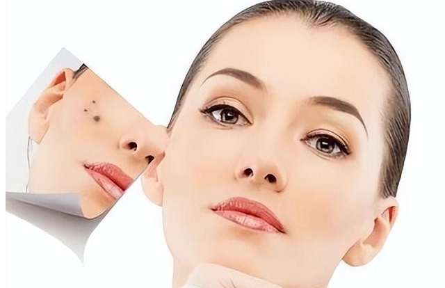 2023昆明哪家整形美容醫(yī)院面部去痣口碑比較好？評分10強你知道嗎？