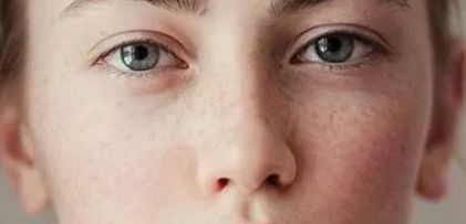 北京喬雅登豐顏注射醫(yī)生口碑排名榜單揭曉，專業(yè)評價一覽