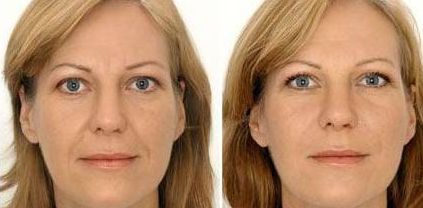 南京皮膚磨削術(shù)醫(yī)院排名榜及價(jià)格超全指南：最新信息全收錄