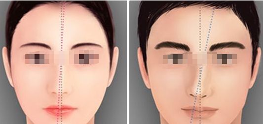 呼和浩特假體隆胸專家排名與價格概覽 260cc型號 2025版