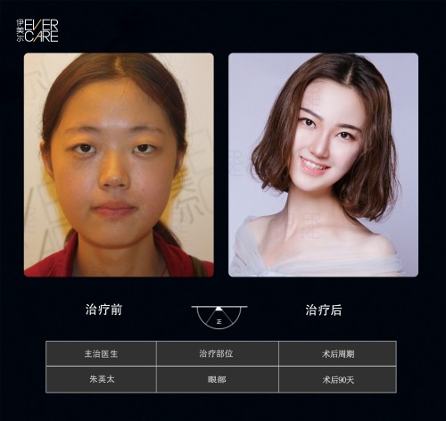 阿爾法9°美眼，打開視界，美無止境