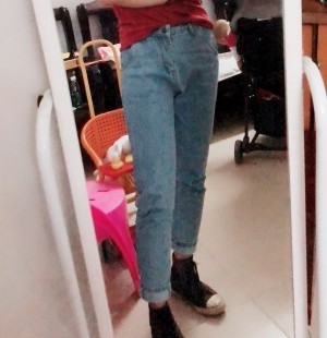 胖腿女孩兒福利分享：吸脂瘦大腿的蛻變，效果值得點(diǎn)贊！