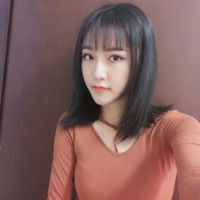 眼綜合術(shù)前VS術(shù)后，自然大眼睛值得稱贊！