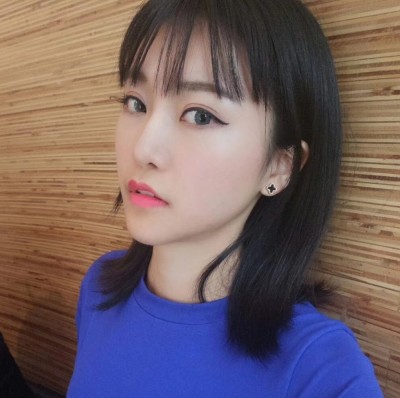 眼綜合術(shù)前VS術(shù)后，自然大眼睛值得稱贊！