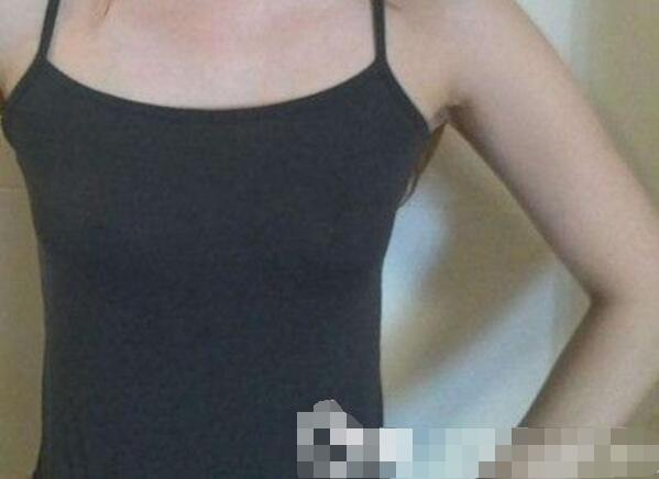 吉安第二醫(yī)院妙桃假體隆胸案例，我一女的都賊喜歡