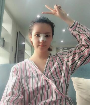 北京葉子整形肋軟骨隆鼻案例反饋，這鼻子是真實(shí)存在的嗎