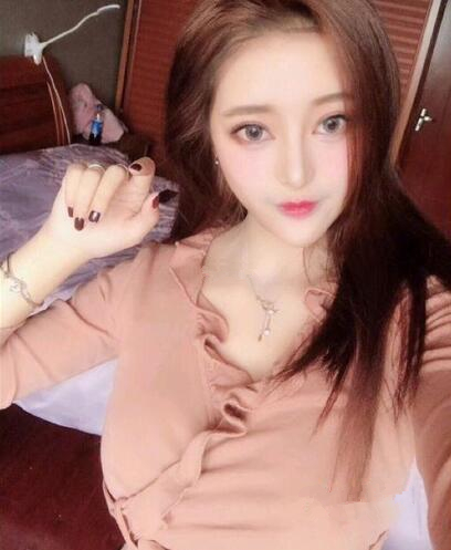 廣州美恩整形下頜角術(shù)后三個月