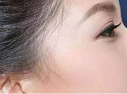 北京市中西醫(yī)結(jié)合醫(yī)院醫(yī)學(xué)整形美容中心玻尿酸豐太陽(yáng)穴