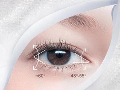 哈爾濱三精女子?？普伍_(kāi)眼角術(shù)后效果