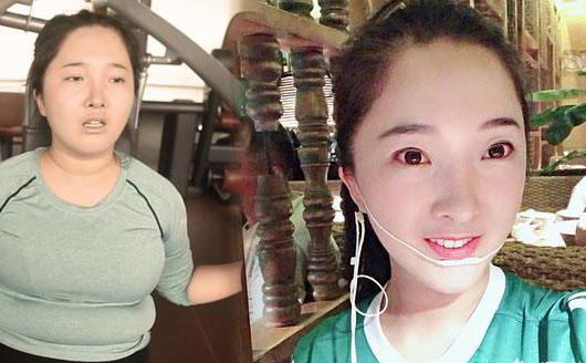 埋線減肥是什么?這種減肥做法具有科學(xué)性嗎?