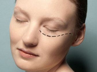 青島王博士醫(yī)學(xué)美容門診部手術(shù)祛眼袋