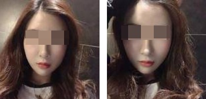 術(shù)前照片 術(shù)前照片