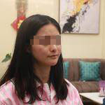 安徽立新醫(yī)學(xué)美容醫(yī)院程立新醫(yī)生面部吸脂案例效果對(duì)比圖