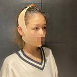 楊力醫(yī)生案例展示