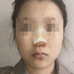 恢復(fù)過(guò)程