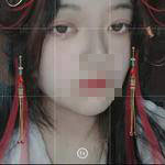 上海亞太醫(yī)療專家周聰做雙眼皮怎么樣？附周聰醫(yī)生雙眼皮案例