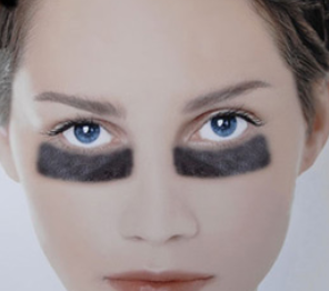 太原麗都整形美容醫(yī)院激光祛黑眼圈