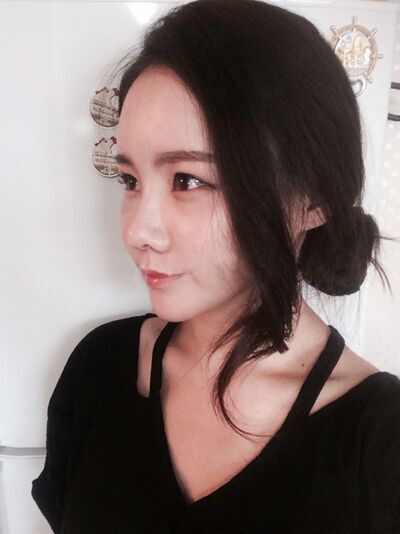 貴陽(yáng)長(zhǎng)江醫(yī)院整形美容中心韓盛斌醫(yī)生做自體脂肪隆鼻+全臉填充案例