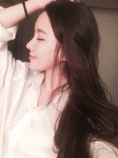 貴陽(yáng)長(zhǎng)江醫(yī)院整形美容中心韓盛斌醫(yī)生做自體脂肪隆鼻+全臉填充案例